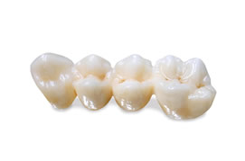 Full Contour Zirconia